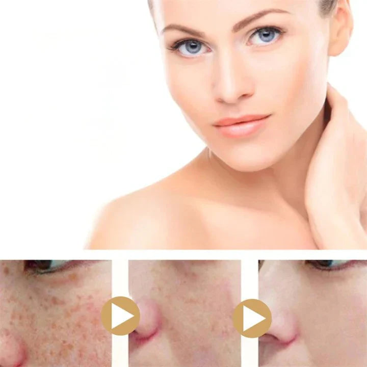 Kurmina Kurkuma Aufhellungsserum – Natürliches Serum gegen dunkle Flecken, Pigmentstörungen und Hautverfärbungen für strahlend glatte Haut