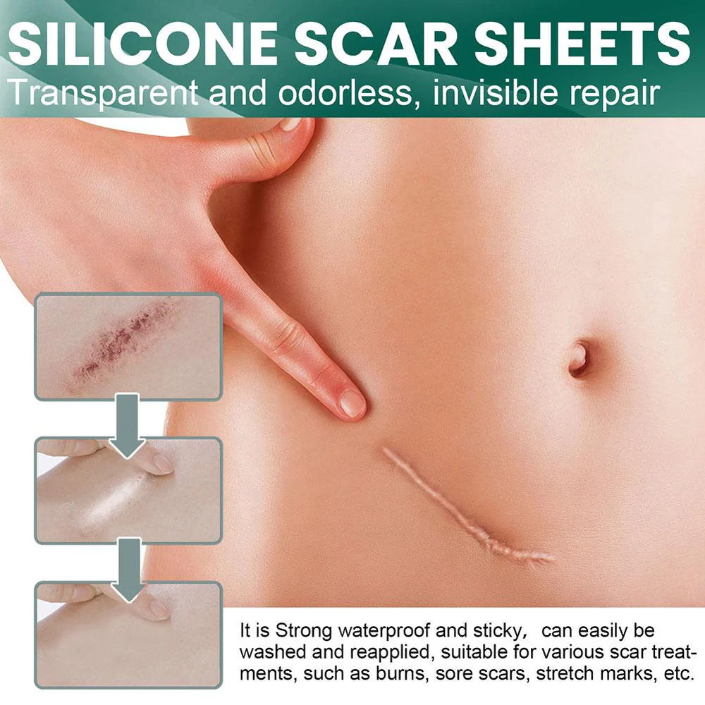 Skinmend™ – Narbenbehandlungstücher für Strahlende Haut | 1 + 1 Gratis
