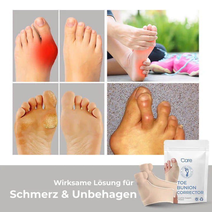 ToeCorrect™ Schmerzfreies Zehenkorrekturband | 50% Rabatt