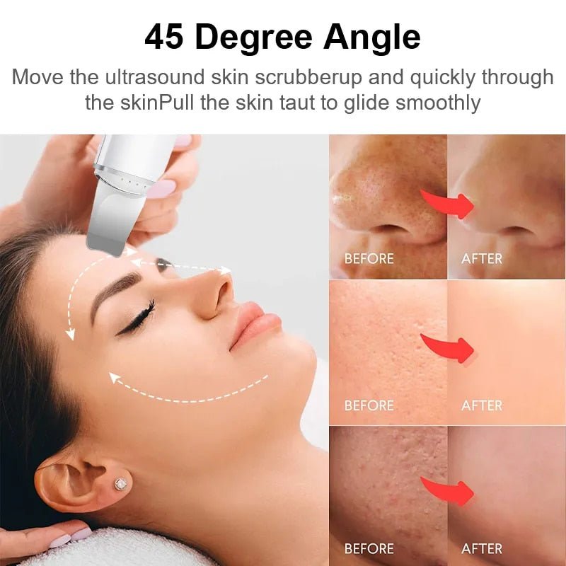 SkinElixir™ - Entdecken Sie makellose Schönheit [50% Rabatt]