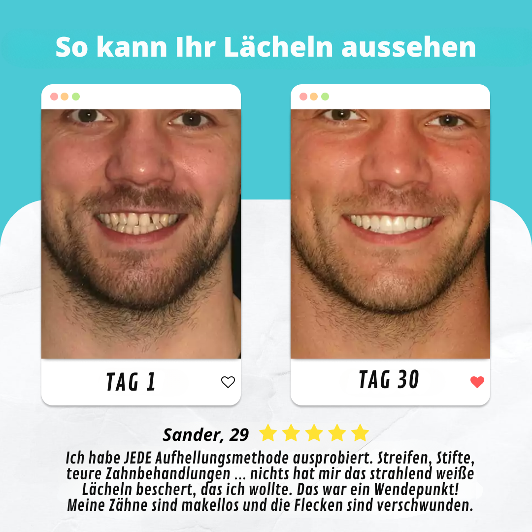 ZahnBlitz 360° Zahnbürste – Automatische, wasserdichte Silikon-Zahnbürste mit UV-Licht und wiederaufladbarem Design